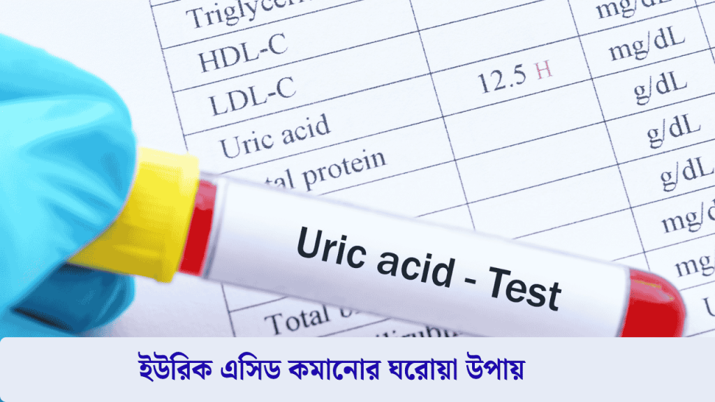 ইউরিক এসিড কমানোর ঘরোয়া উপায়